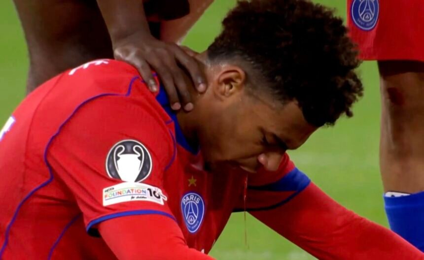 Désiré Doué spitting blood